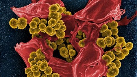 Scientists find link between common weedkiller and superbugs