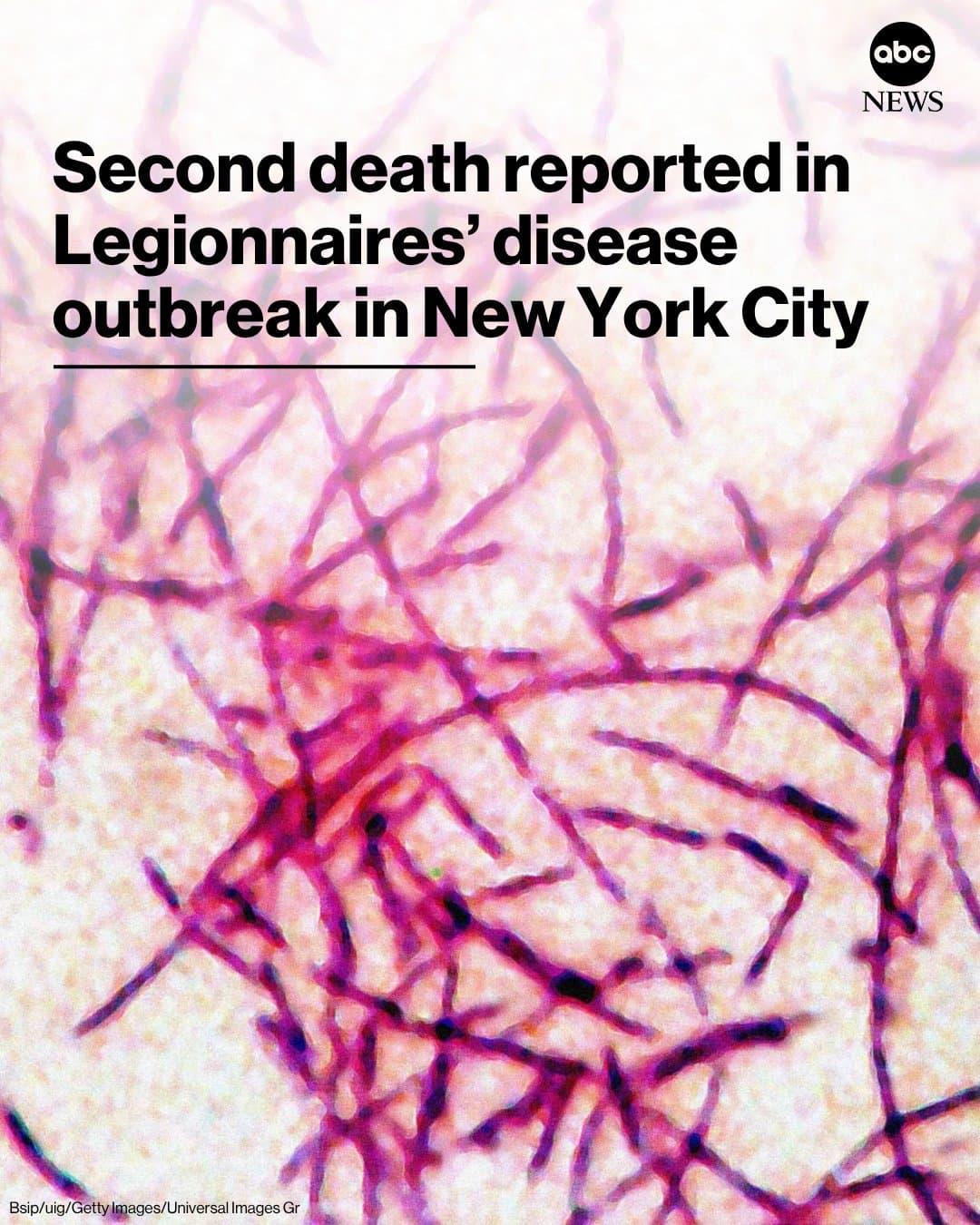 Legionnaires’ Disease Outbreak Claims Second Life in New York City