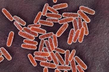Russian Anti-Plague Lab Worker Dies of Suspected Pneumonic Plague as 200 Remain Under Observation