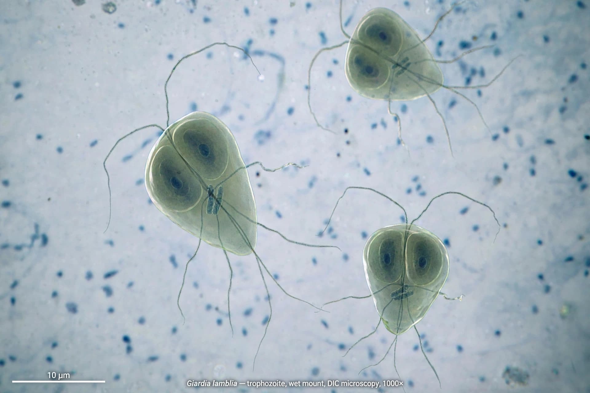 Schoolyard scourge on its last legs after ‘striking’ Qld lab discovery.