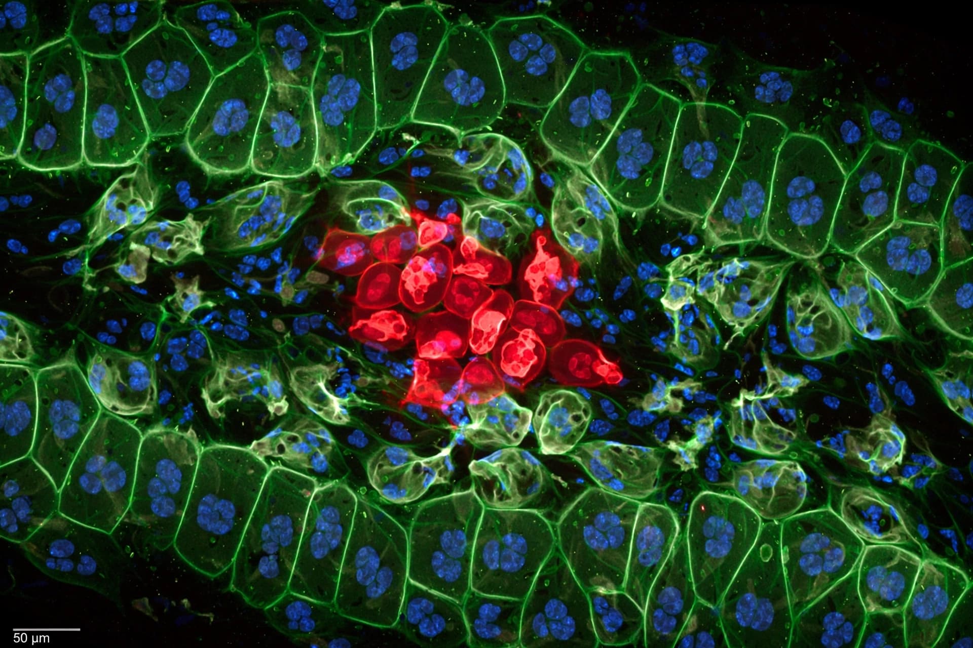 In the tissue community, p53 loss teaches cells to win by killing