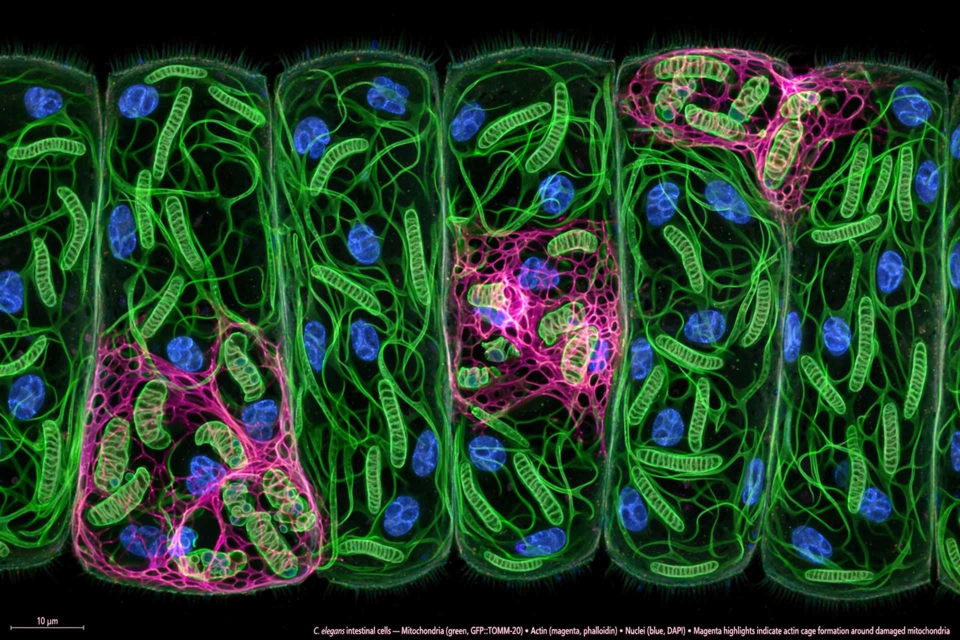 A Calcium Signal Builds a Cage Around Damaged Mitochondria A Calcium Signal Builds a Cage Around Damaged Mitochondria