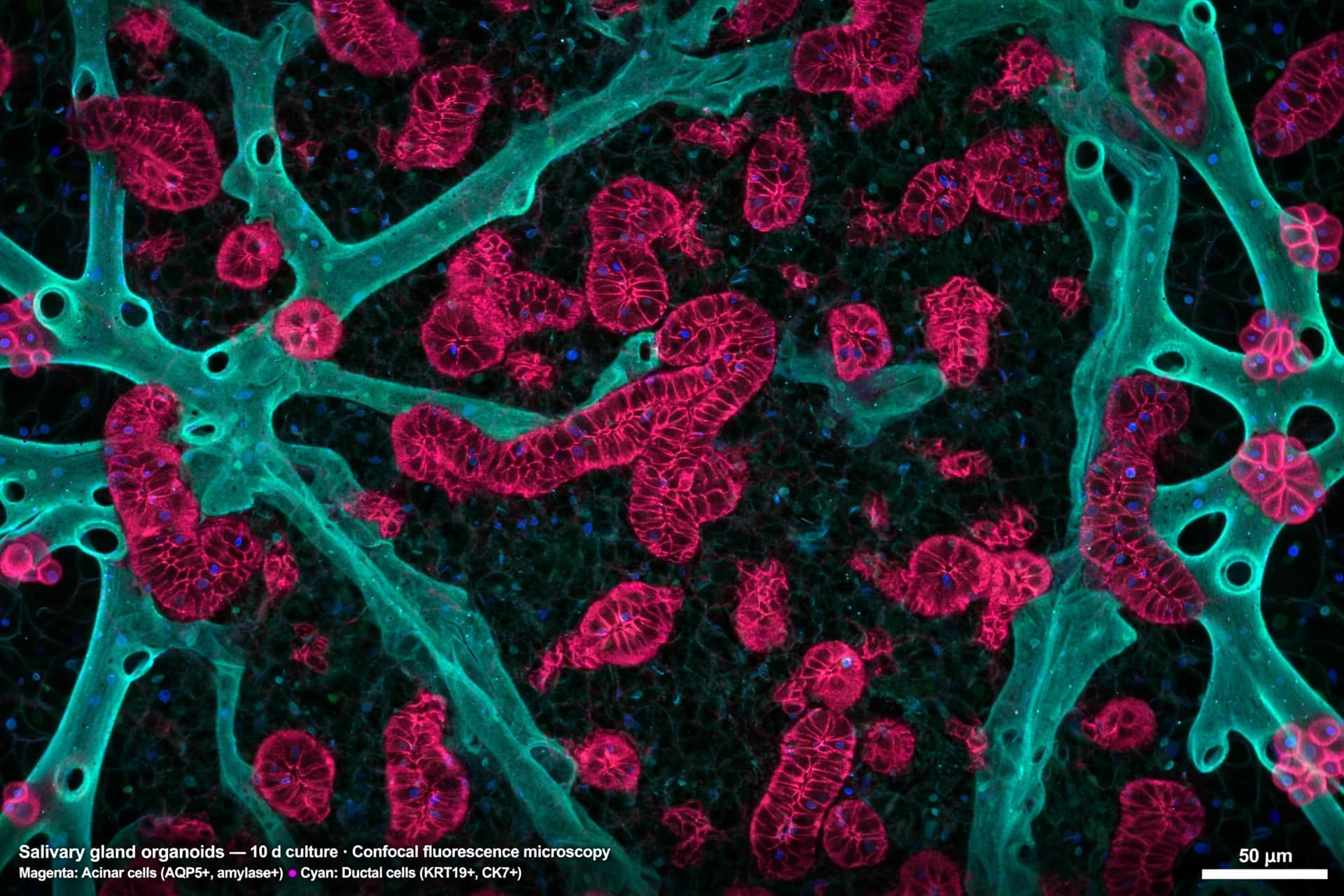 What if the answer to dry mouth is a mini-organ grown from your own cells? What if the answer to dry mouth is a mini-organ grown from your own cells?
