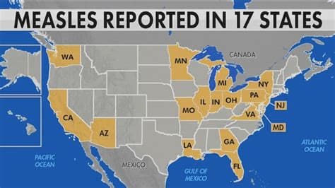 Pennsylvania Health Officials Brace as Measles Outbreak Expected to Spread Pennsylvania Health Officials Brace as Measles Outbreak Expected to Spread
