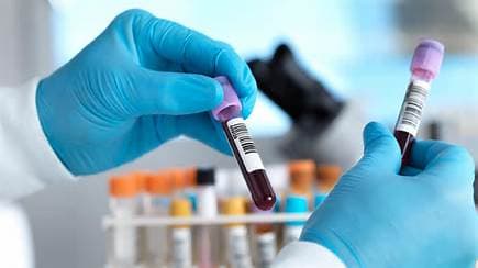 England Set to Eliminate Hepatitis C England Set to Eliminate Hepatitis C