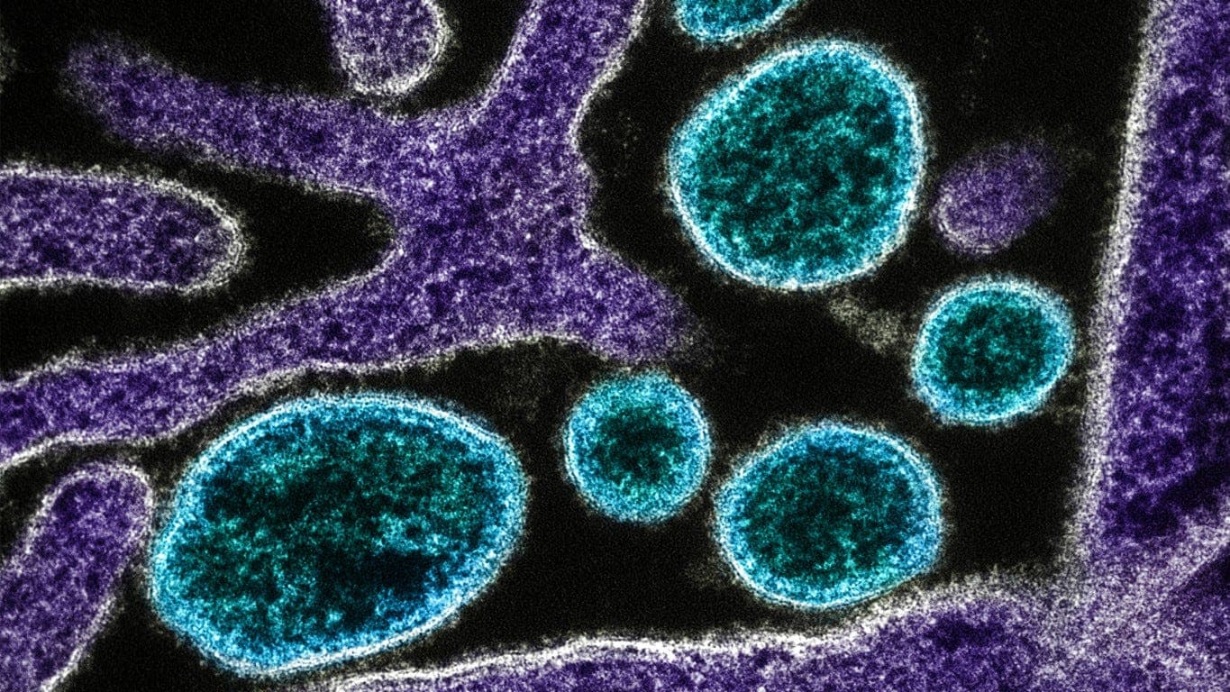 New Nipah Virus Outbreak in India Raises Concern Across Asia New Nipah Virus Outbreak in India Raises Concern Across Asia