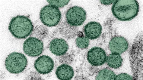 Australians from Hantavirus Cruise Ship to Fly Out of Netherlands in Full PPE After Plane and Crew Secured Australians from Hantavirus Cruise Ship to Fly Out of Netherlands in Full PPE After Plane and Crew Secured