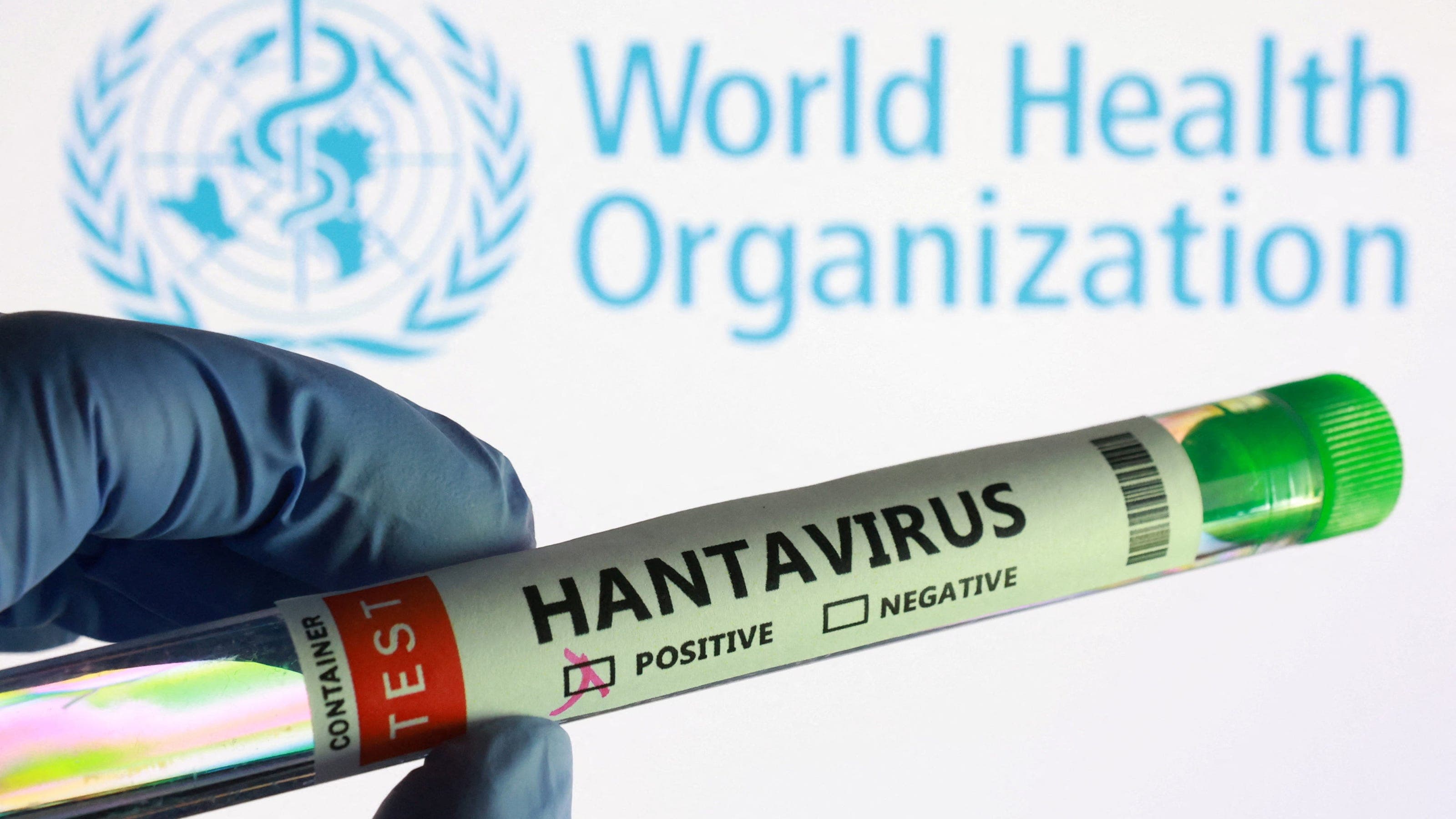 Canada Confirms First Hantavirus Case in Isolation in British Columbia Canada Confirms First Hantavirus Case in Isolation in British Columbia