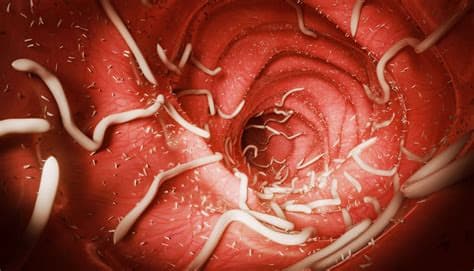 US outbreak of parasite causing watery diarrhea tops 2,800 cases US outbreak of parasite causing watery diarrhea tops 2,800 cases