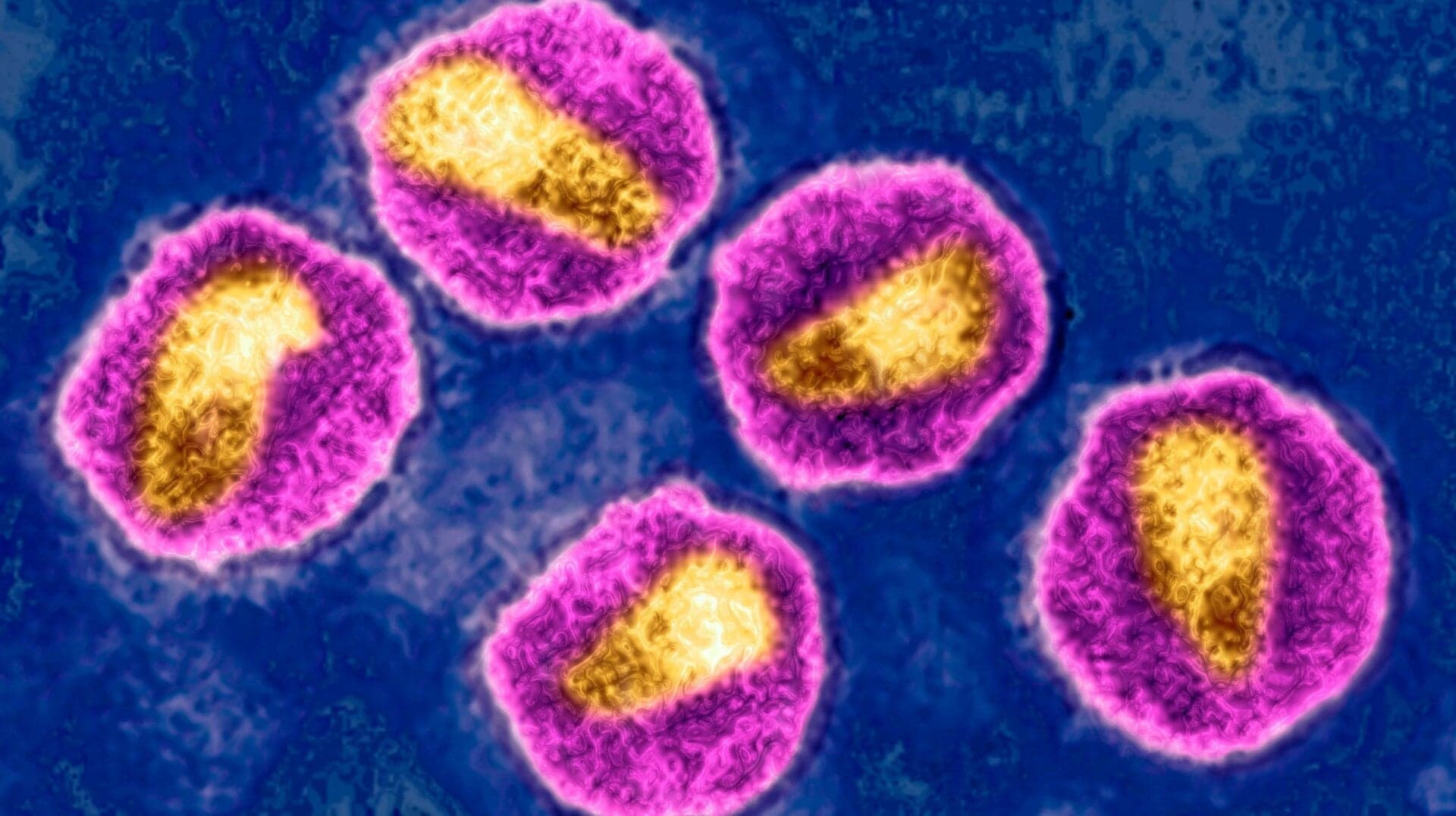 Norway Man Cured of HIV With Brother’s Stem Cells Norway Man Cured of HIV With Brother’s Stem Cells