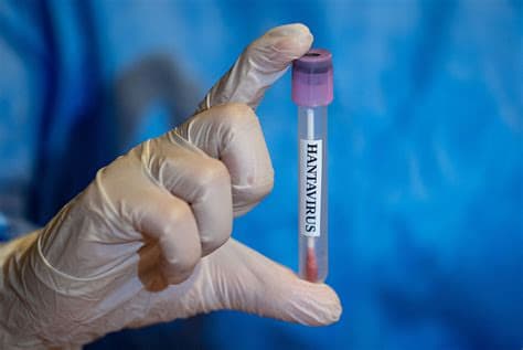 One US Citizen Tests Mildly Positive for Hantavirus; Another Exhibits Mild Symptoms One US Citizen Tests Mildly Positive for Hantavirus; Another Exhibits Mild Symptoms