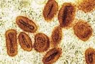 Two Scientists Charged for Bringing Deactivated Mpox Virus into the U.S. and Deceiving Authorities Two Scientists Charged for Bringing Deactivated Mpox Virus into the U.S. and Deceiving Authorities