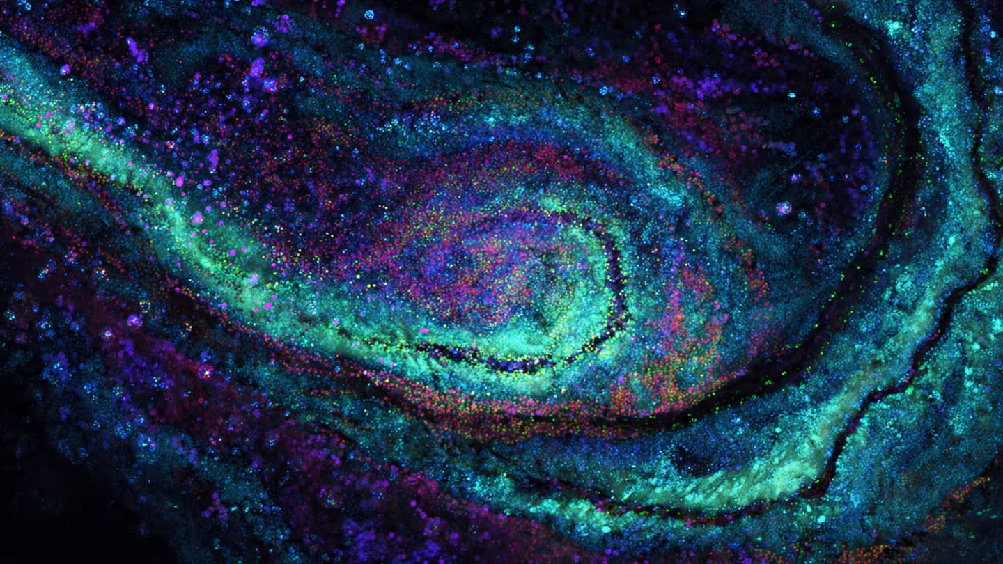 A Hidden Galaxy Inside Human Hearing Comes Into View A Hidden Galaxy Inside Human Hearing Comes Into View